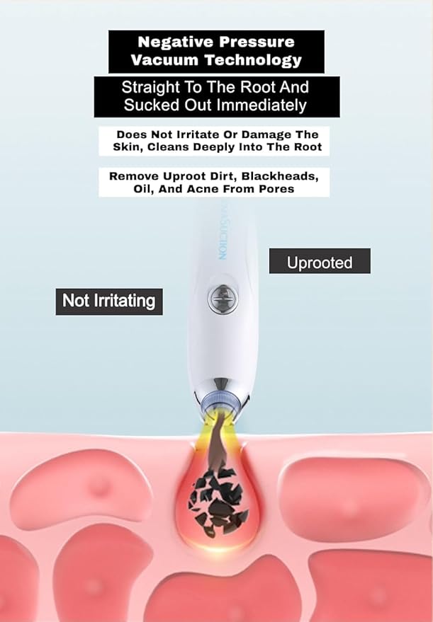 4 in 1 Multi-Function Blackhead Whitehead Extractor Remover Device, Skin Cleaner, Pimple Removal Tool