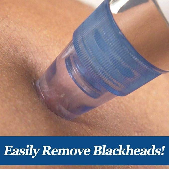 4 in 1 Multi-Function Blackhead Whitehead Extractor Remover Device, Skin Cleaner, Pimple Removal Tool