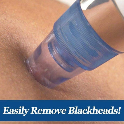 4 in 1 Multi-Function Blackhead Whitehead Extractor Remover Device, Skin Cleaner, Pimple Removal Tool